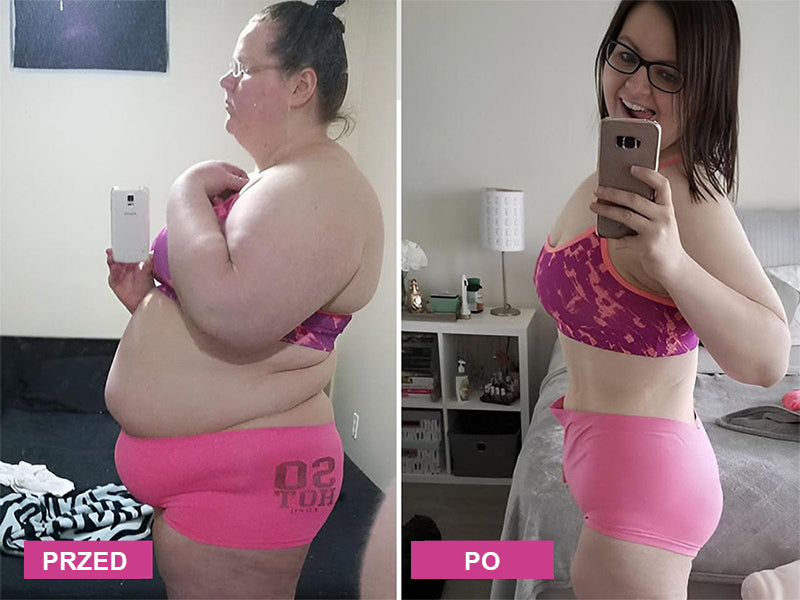 Curalona® Natychmiastowe Ukojenie Świądu i Detoks oraz Wyszczuplanie i Ujędrnianie – Regeneracja i Naturalne Kapsułki „Różowość i Delikatność” PRO