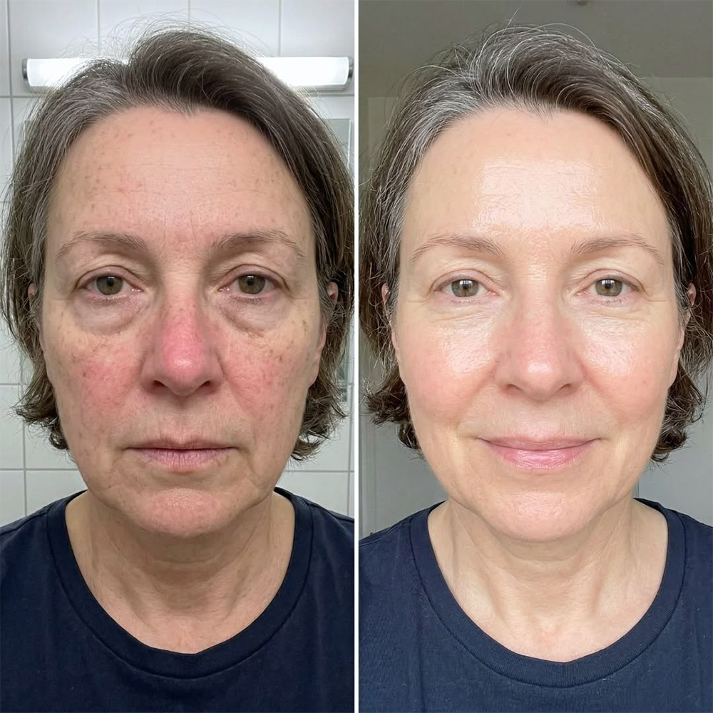 💖【Oficjalny Sklep】PURELORA® AdaptaShade Foundation — Dopasowujący się do kolorytu podkład z pielęgnacyjną formułą
