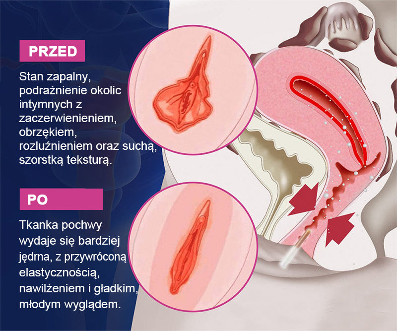 Curalona® Natychmiastowe Ukojenie Świądu i Detoks oraz Wyszczuplanie i Ujędrnianie – Regeneracja i Naturalne Kapsułki „Różowość i Delikatność” PRO