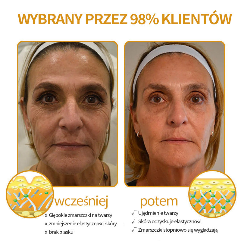 🔥Ostatni dzień wyprzedaży: 70% zniżki – krem przeciwzmarszczkowy Purelora® Botox z jadem pszczelim