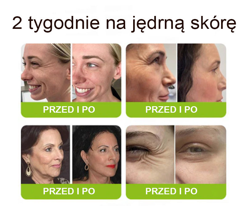 [🔥Ostatni dzień: 70% taniej] Preparat Purelora® (efekt botoksu i retinolu) – sposób na głębokie zmarszczki, opadające policzki i opuchliznę pod oczami