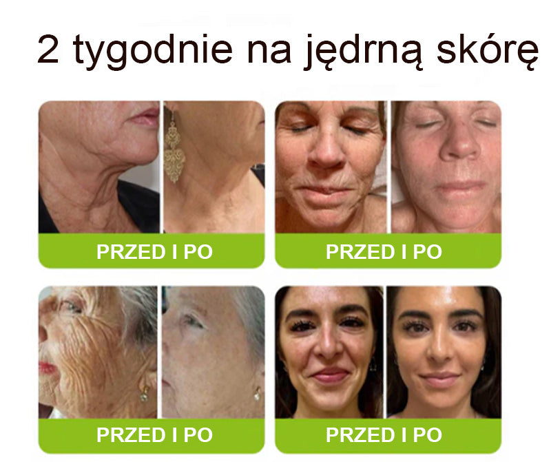 [🔥Ostatni dzień: 70% taniej] Preparat Purelora® (efekt botoksu i retinolu) – sposób na głębokie zmarszczki, opadające policzki i opuchliznę pod oczami