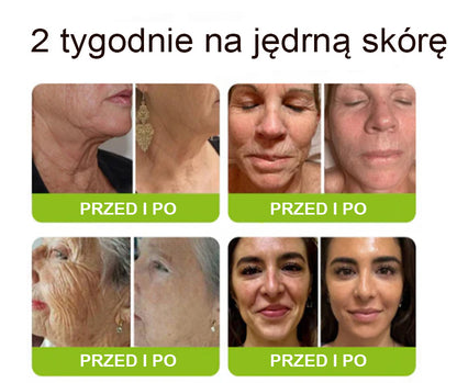 [🔥Ostatni dzień: 70% taniej] Preparat Purelora® (efekt botoksu i retinolu) – sposób na głębokie zmarszczki, opadające policzki i opuchliznę pod oczami