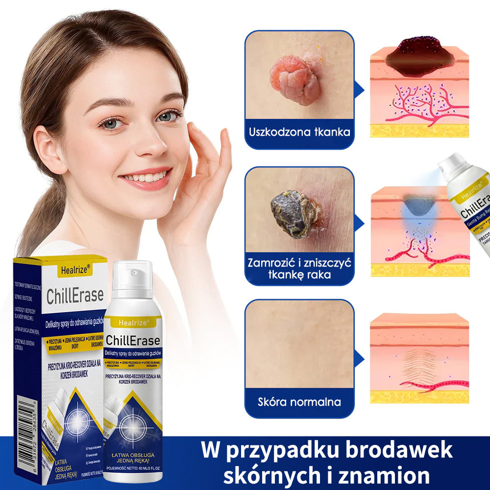 ❄️Healrize® ChillErase – Delikatny spray regenerujący na uporczywe grudki i szorstkie miejsca na skórze