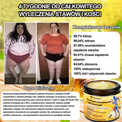 Purelora® – Krem przeciwbólowy i wspomagający regenerację kości z toksyną botulinową i jadem pszczelim