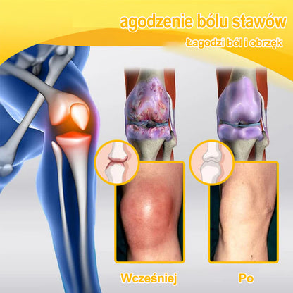 Purelora® – Krem przeciwbólowy i wspomagający regenerację kości z toksyną botulinową i jadem pszczelim