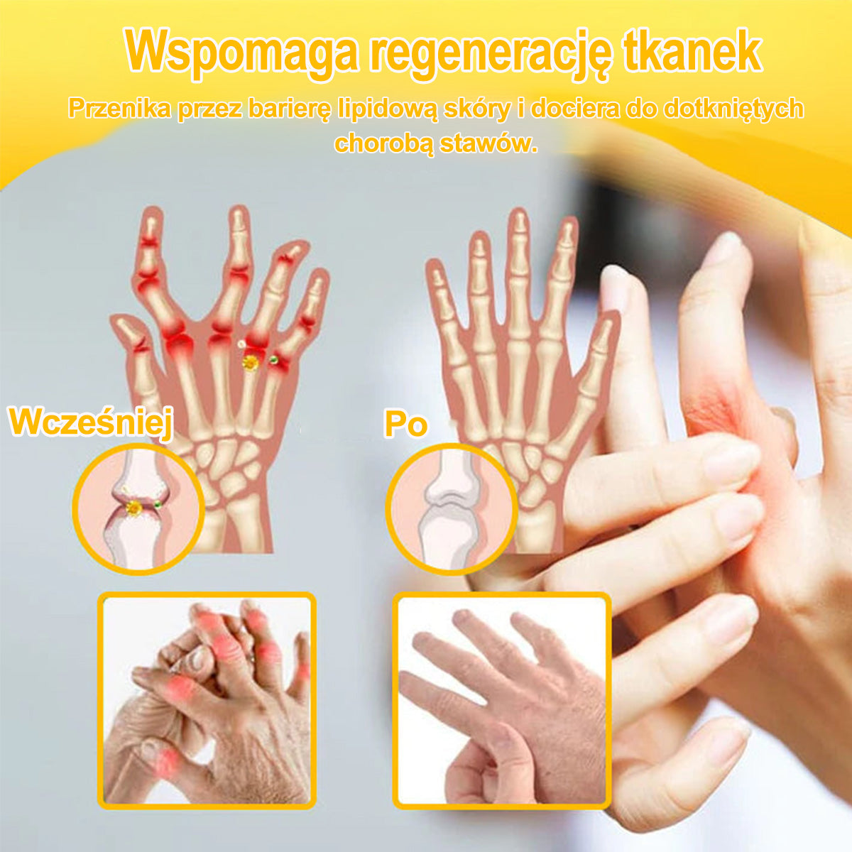 Purelora® – Krem przeciwbólowy i wspomagający regenerację kości z toksyną botulinową i jadem pszczelim