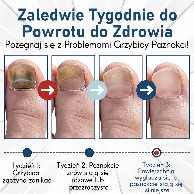 Purelora® – bioaktywny system głęboko wnikający przeciw grzybicy paznokci