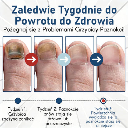 Purelora® – bioaktywny system głęboko wnikający przeciw grzybicy paznokci
