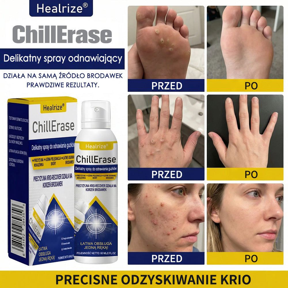 ❄️Healrize® ChillErase – Delikatny spray regenerujący na uporczywe grudki i szorstkie miejsca na skórze