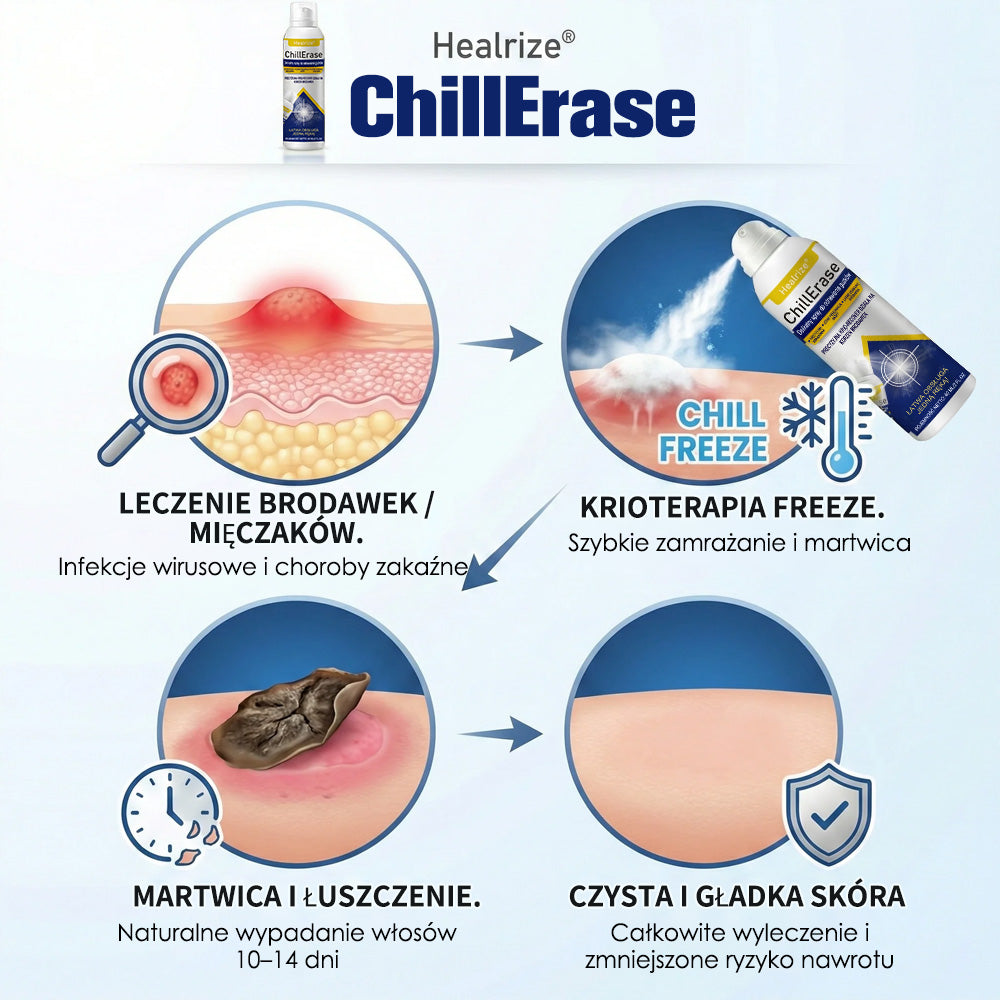 ❄️Healrize® ChillErase – Delikatny spray regenerujący na uporczywe grudki i szorstkie miejsca na skórze