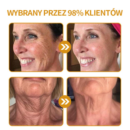 🔥Ostatni dzień wyprzedaży: 70% zniżki – krem przeciwzmarszczkowy Purelora® Botox z jadem pszczelim