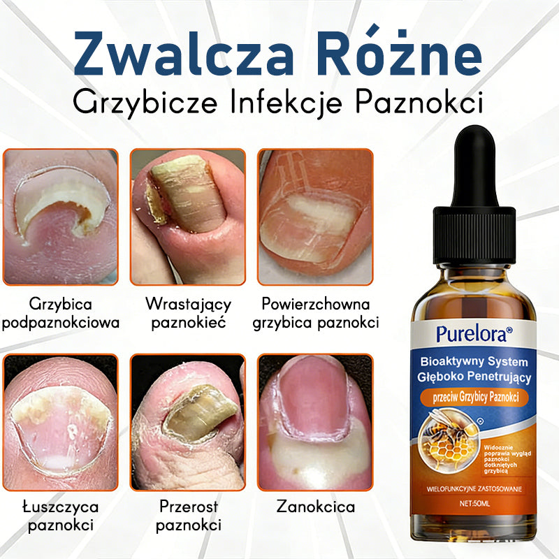 Purelora® – bioaktywny system głęboko wnikający przeciw grzybicy paznokci