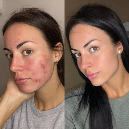 💖【Oficjalny Sklep】PURELORA® AdaptaShade Foundation — Dopasowujący się do kolorytu podkład z pielęgnacyjną formułą